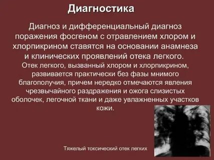 Отеки при интоксикации