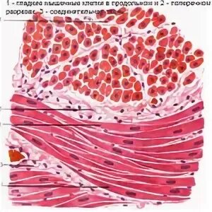 Клетки поперечно полосатой мышечной ткани в отличие