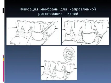 Техника направленная
