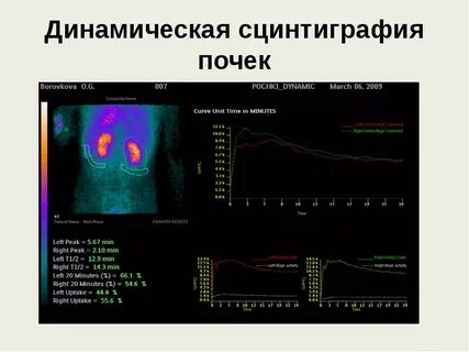 Стенография почек