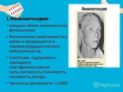 Классическая фенилкетонурия по утвержденным