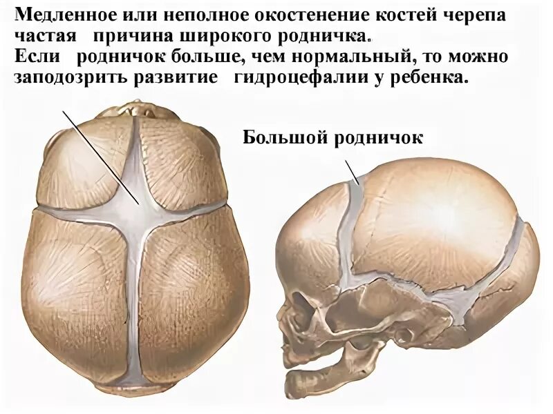 Сколько родничков у ребенка. Роднички черепа зарастают к. Родничок и темечко у новорожденных. Темечко у новорожденных темечко. Форма большого родничка у новорожденных.