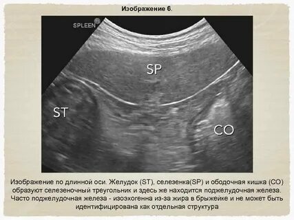 Узи печени селезенки поджелудочной