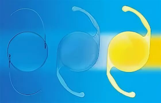 Типы линз иол. Хрусталик acrysof iq. Хрусталик американский алкон. Интраокулярные линзы иол tecnis toric. Хрусталик американский алкон.