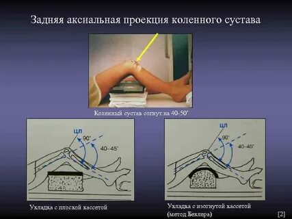 Аксиальная проекция