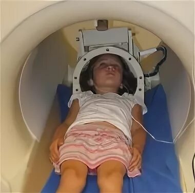 Мрт головного мозга детям года