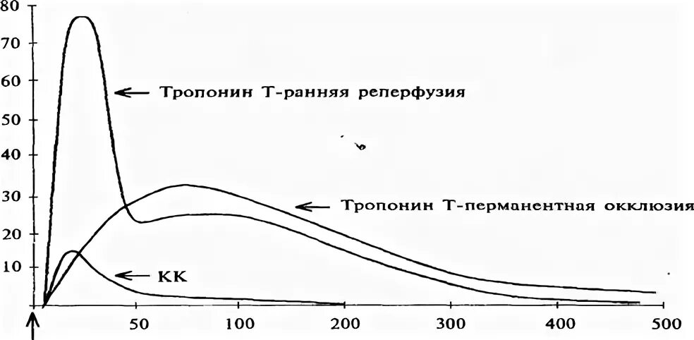 Тропонин норма у мужчин. Тропонин при остром инфаркте. Динамика уровня тропонина. Динамика уровня тропонина при инфаркте миокарда. Динамика тропонина при ОИМ.