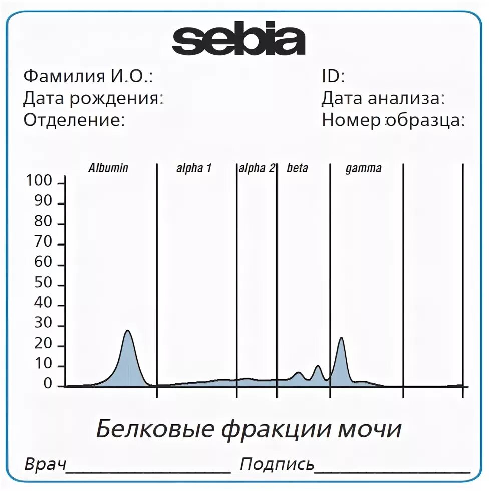 Фракции белков норма. Электрофорез белковых фракций крови. Электрофорез белков нормы фракций. Электрофорез белков сыворотки крови норма. Капиллярный электрофорез белков сыворотки крови.