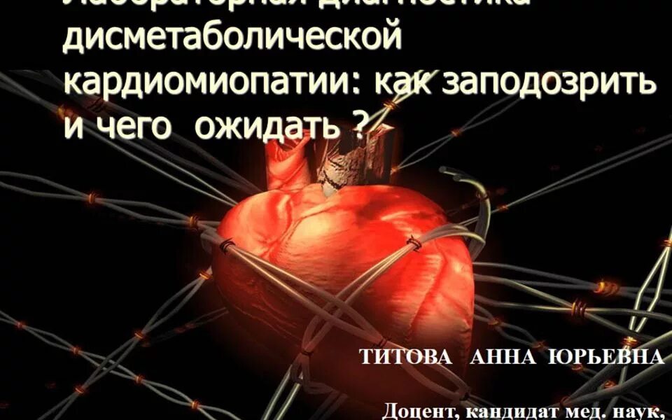 Дисметаболическая кардиомиопатия мкб. Дисметаболическая кардиомиопатия. вторичные кардиомиопатии. дисметаболическая кардиопатия симптомы. лабораторная диагностика кардиомиопатии.
