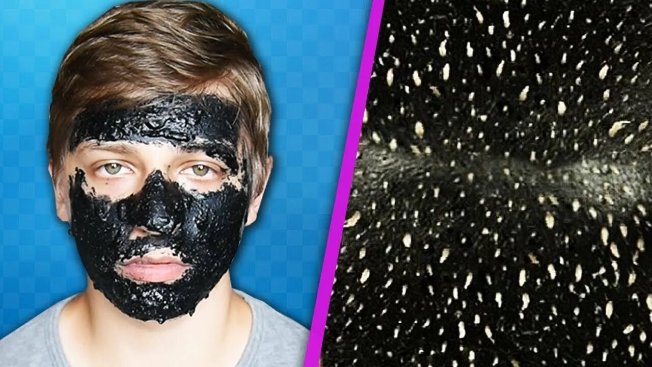 Masks removed