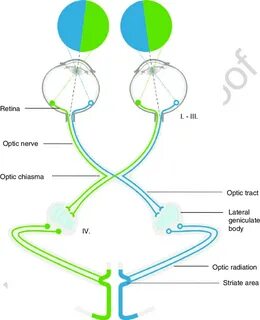 Visual system