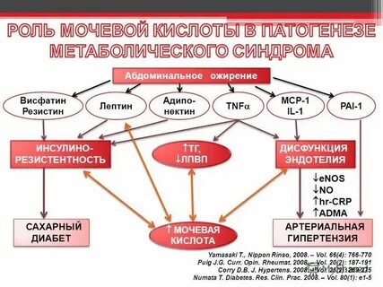 Метаболический синдром печени