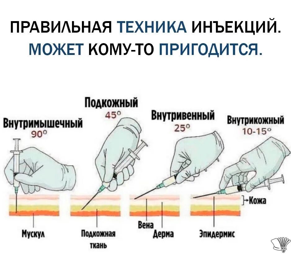 Градусы введения иглы. Алгоритм введения внутримышечной инъекции. Как правильно держать шприц. Как правило держать шприц. Внутрикожная инъекция оборудование.