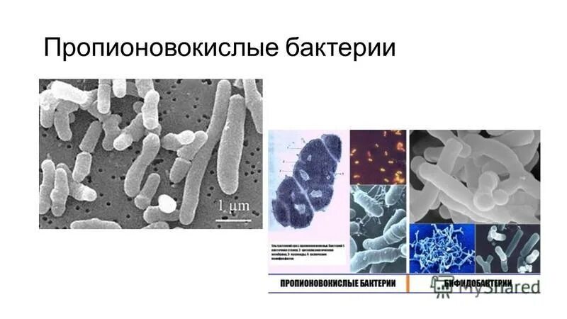 Прнпионово кислые бактерии. Пропионовокислые бактерии закваска. Пропионовокислые бактерии брожение. Пропионовокислое брожение микробиология. Аэротолерантные системы защиты.