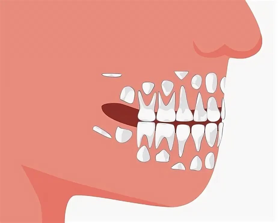 Doctors remove 526 'tooth-like structures' from 7-year-old boy's mouth
