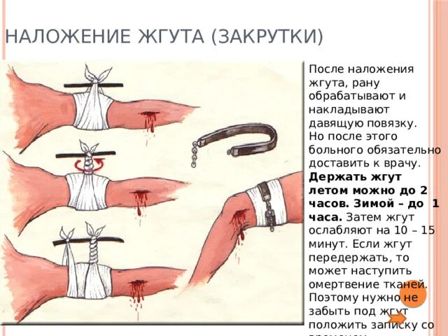 Через сколько ослаблять жгут. Через сколько ослаблять жгут