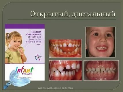 Прикус в год