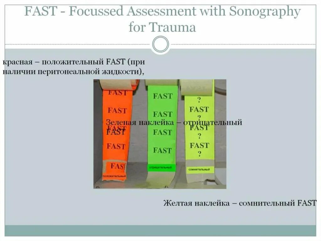 Фаст протокол УЗИ. Пример fast протокола. Фаст протокол при травме. Fast протокол