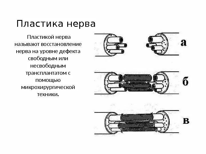 Сколько времени восстанавливается нерв. Сколько времени восстанавливается нерв