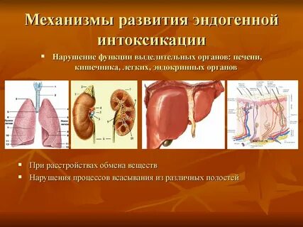 Эндогенная интоксикация