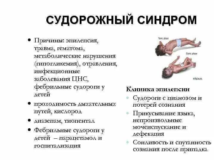 Синдромы при эпилепсии. Судороги эпилепсия у детей симптомы. Судорожный синдром неврология. Характеристика судорожный синдром у детей. Судороги при эпилепсии у детей.