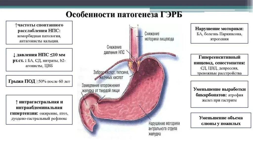 Диагностика рефлюкса. Клинические проявления рефлюкс эзофагита. Газоэзофагальнаярефлюксная болезнь. Рефлюксная болезнь желудка рефлюкс. Гастроэзофагеальная рефлюксная болезнь симптомы.