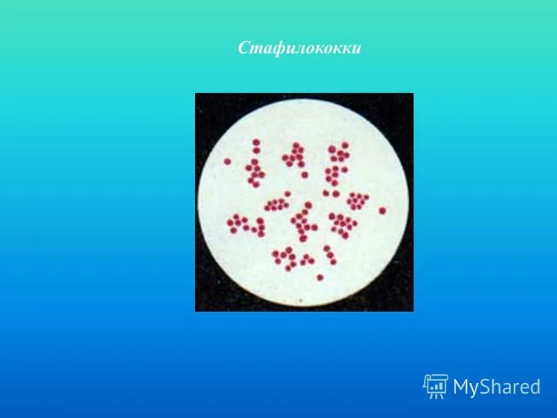 Staphylococcus aureus степени