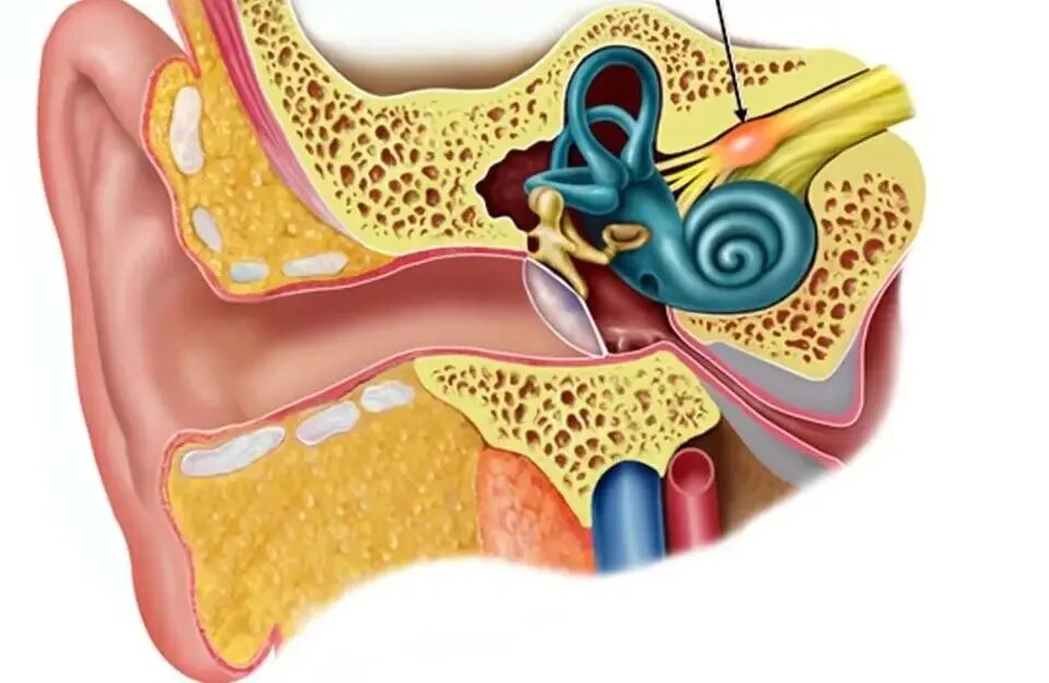 Вестибулярный неврит. Вестибулярный нерв внутреннего уха. Строение уха и вестибулярного аппарата. Кохлеарный неврит. Воспаление внутреннего уха лечение