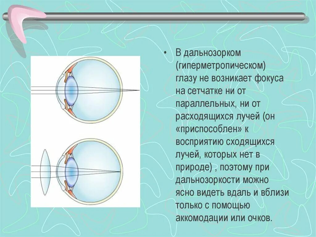 Коррекция аккомодации. Механизм аккомодации хрусталика. Дальнозоркий глаз схема физика. Механизмы аккомодации и рефракции. Зрительный анализатор аккомодация.