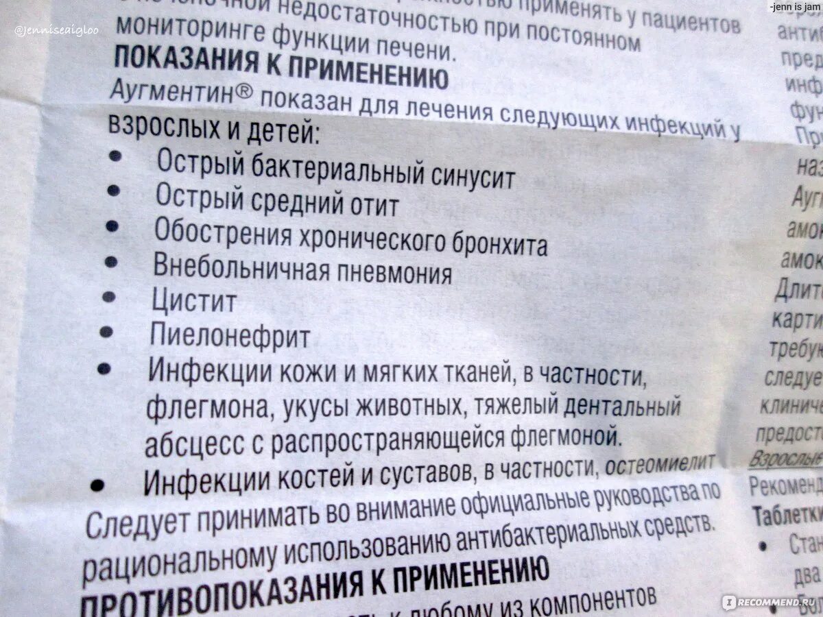 Аугментин 1000 инструкция отзывы. Антибиотик Аугментин 500 мг. Аугментин таблетки 875 мг + 125 мг. Аугментин 500мг антибиотик 500. Антибиотик Аугментин инструкция.