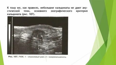 Узи малых желез