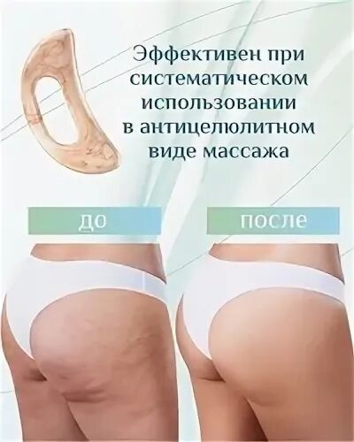Массаж тела гуаша схема антицеллюлитный