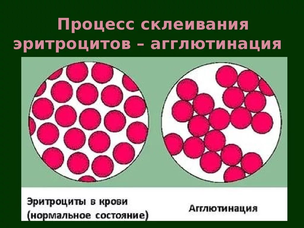 Реакция агглютинации эритроцитов. Реакция агглютинации при переливании. Переливание крови агглютинация. Реакция агглютинации эритроцитов крови.