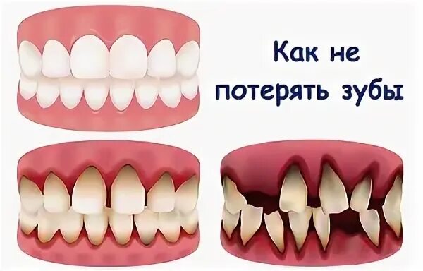 Улыбка с зубами. Как укрепить шатающийся. Зубная нить зубы. Как укрепить шатающийся. Как укрепить шатающийся.