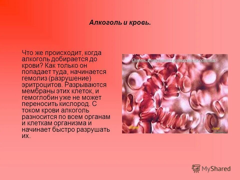 В организме человека происходит разрушение эритроцитов. Влияние алкоголя на кровь. влияние алкоголя на кровь человека. влияние этанола на кровь. эритроциты алкоголика.