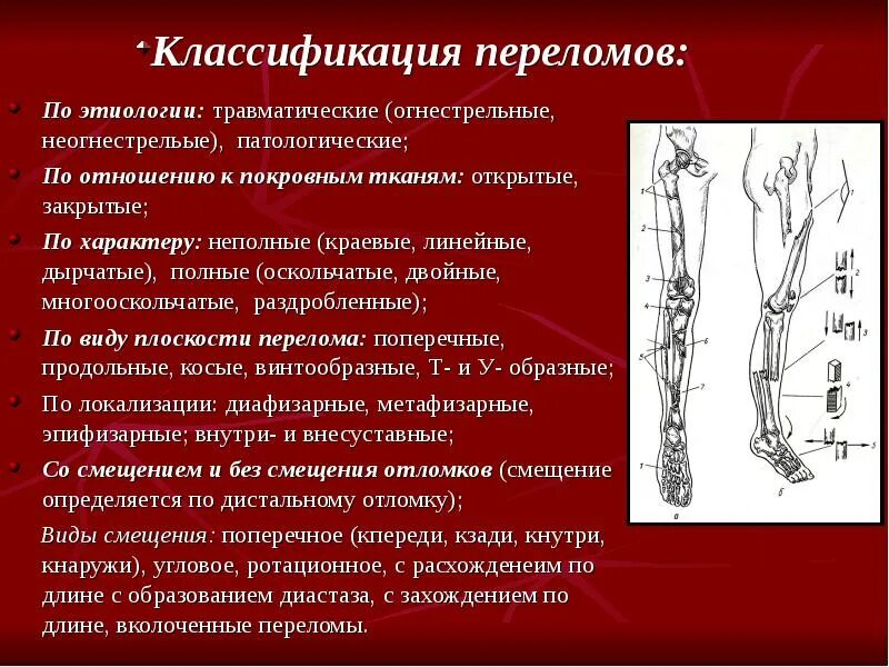 Для перелома характерно тест. Перелом классификация переломов. Классификация оскольчатых переломов. Классификация переломов костей. Классификация переломов оскольчатый.