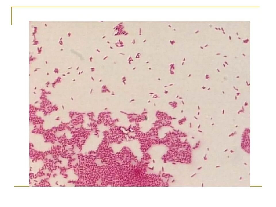 Неклостридиальная анаэробная инфекция. Микроскопия bacteroides fragilis. Бактероиды фрагилис. Bacteroides fragilis возбудитель. Бактероиды анаэробы.