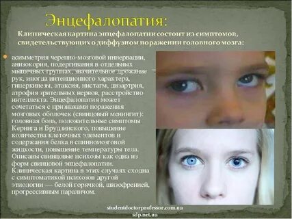 Энцефалопатия что это такое простыми словами