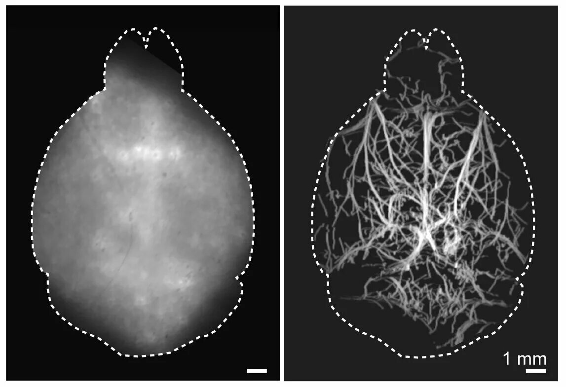 Method scans