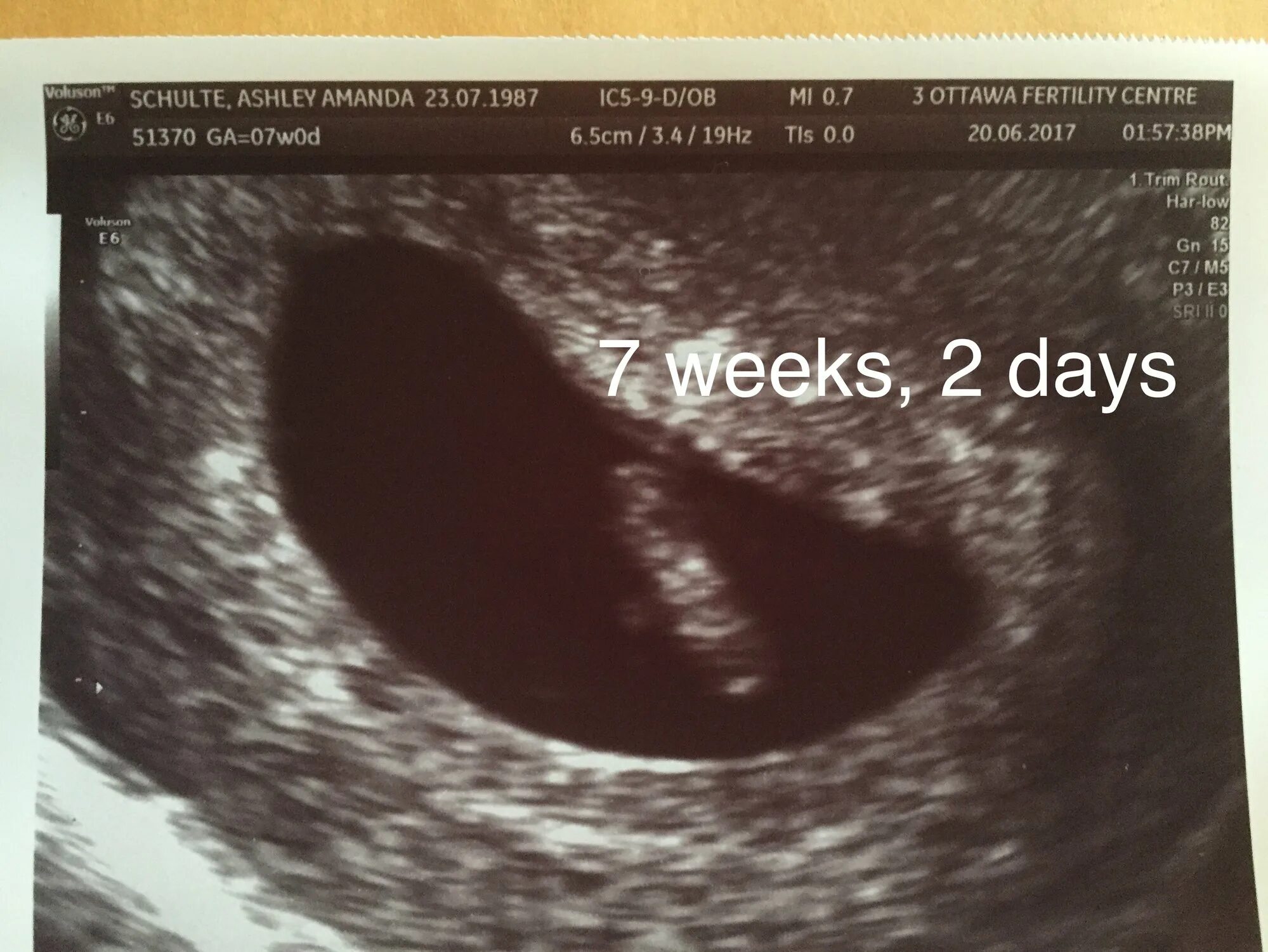 7 weeks. 7 Weeks and 3 Days yungatita. Week 7.