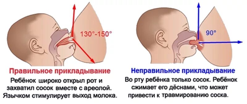 Новорожденный заглатывает воздух. Неправильное прикладывание к груди. Неправильное прикладывание ребенка. Правильный захват груди. Правильный захват груди ребенком.