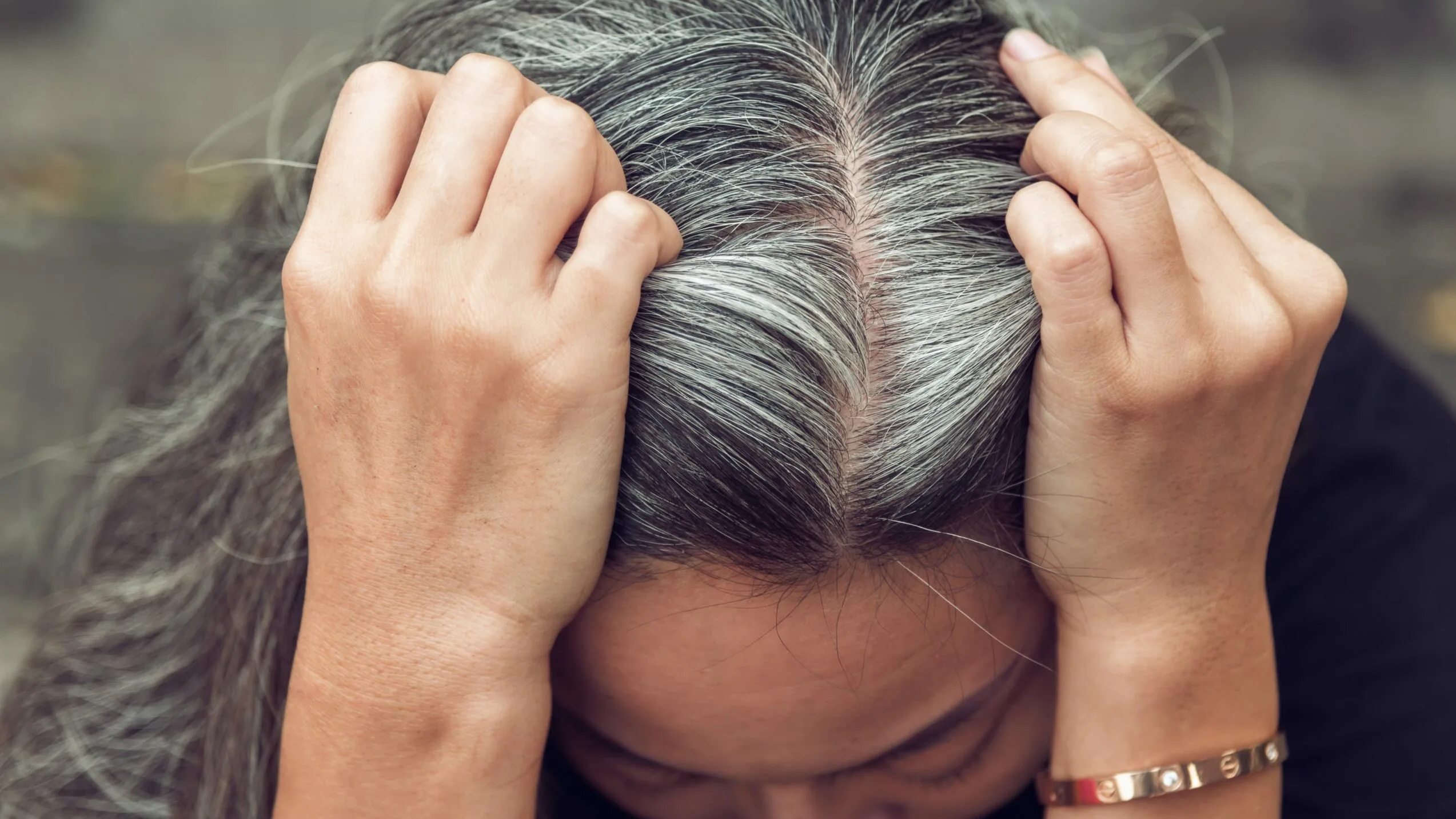 Ранняя седина волос. Девушка в шоке. Волос избавление от седины. Седина от стресса. Волосы с проседью.