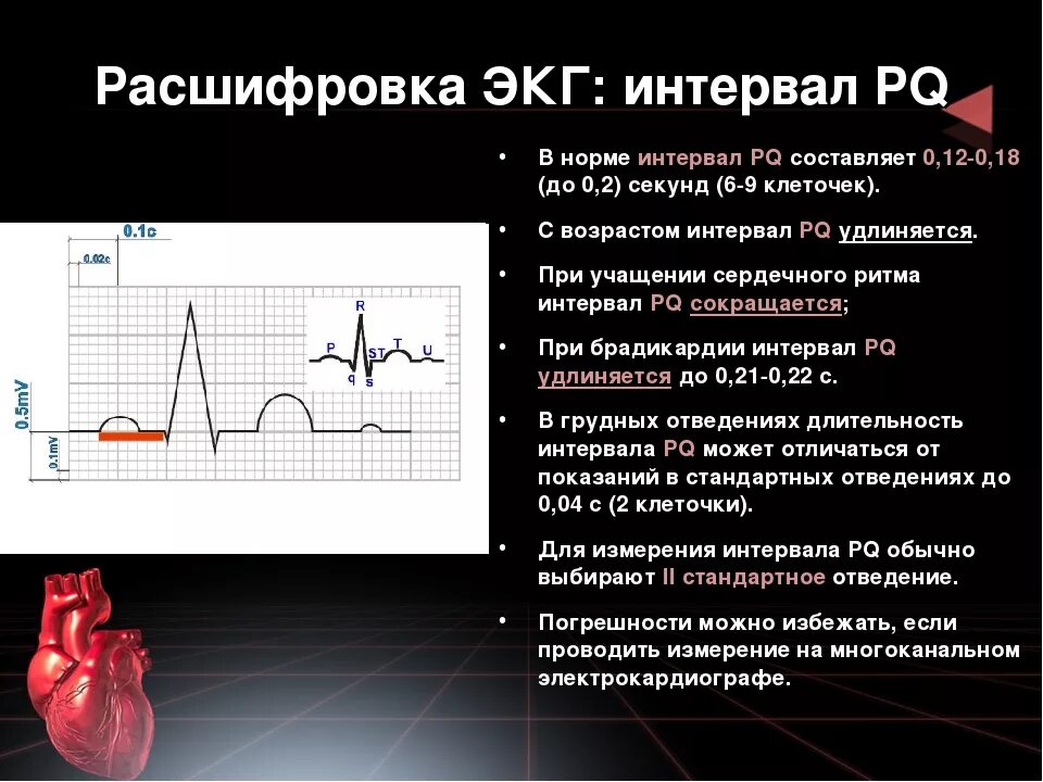 Интервал pr. Нормальные показатели интервалов экг. продолжительность интервалов экг в норме. pq,130 расшифровка экг. интервал pq на экг норма таблица.