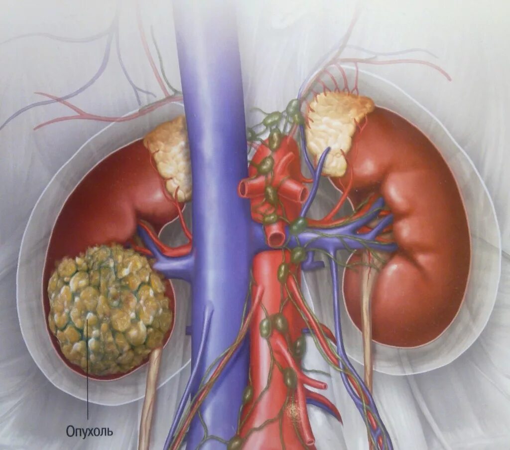 Advanced Gastroenterology and Surgery Associates - Colon Cancer Screening - YouT