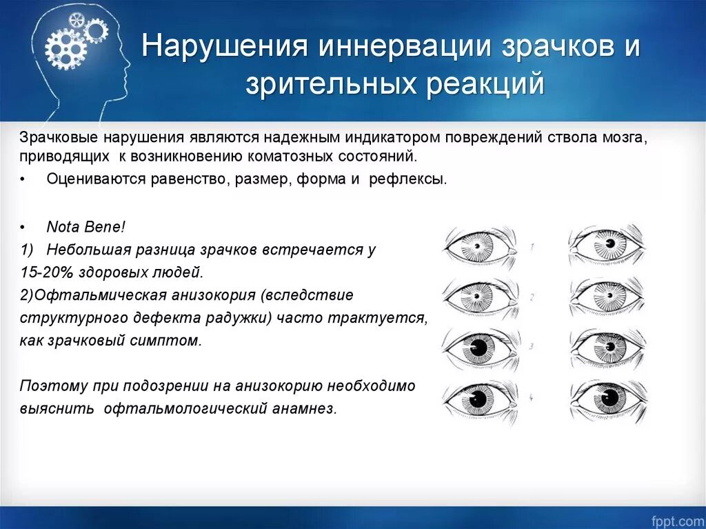 Расширение зрачка какой отдел. Исследование реакции зрачков на свет. Реакция зрачка на свет неврология. Нарушение реакции зрачков на свет. Расширение зрачка на стороне поражения.