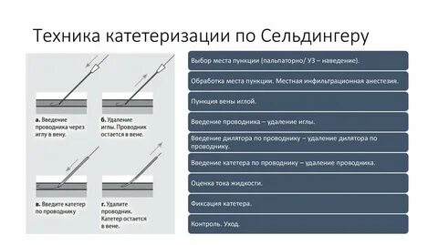 Постановка катетера манипуляция