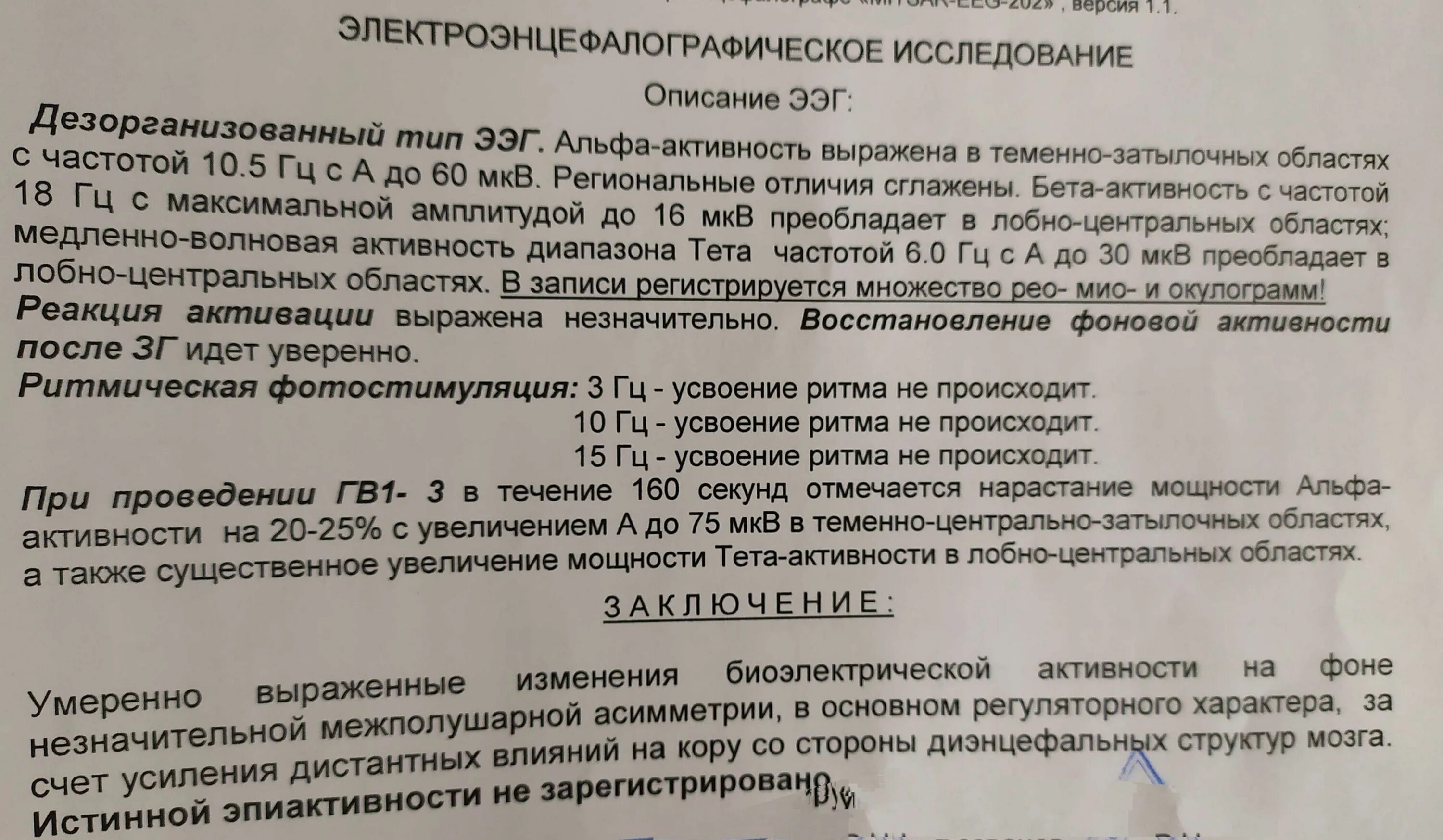 Умеренные диффузные изменения корковой ритмики. Умеренные диффузные изменения корковой ритмики