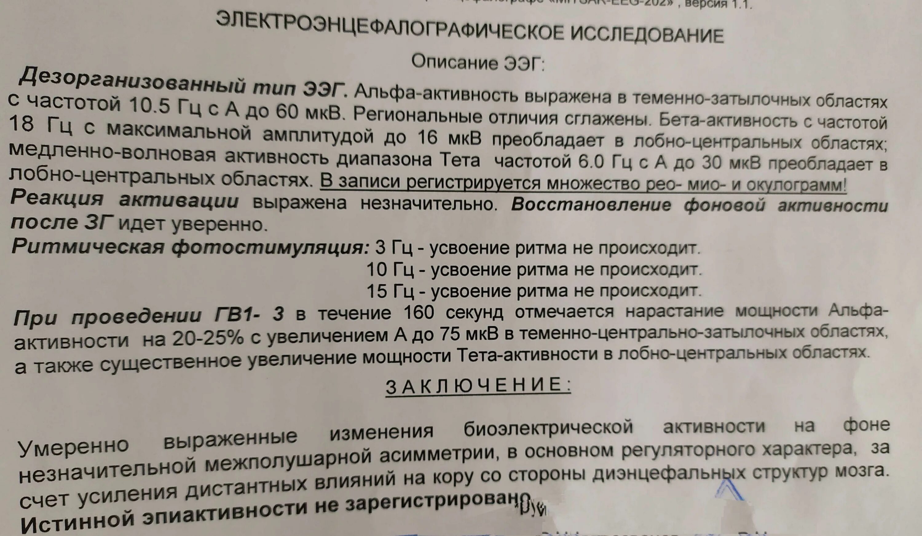 Заключение ЭЭГ. Нормальное заключение ЭЭГ. ЭЭГ расшифровка. Примеры ЭЭГ С расшифровкой. Изменения бэа головного мозга что это