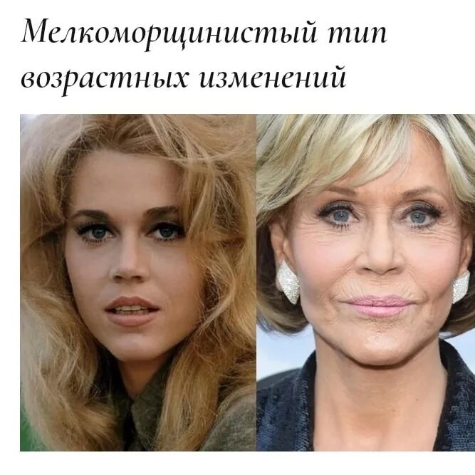 Тип старения примеры. Усталый морфотип. морфотип.