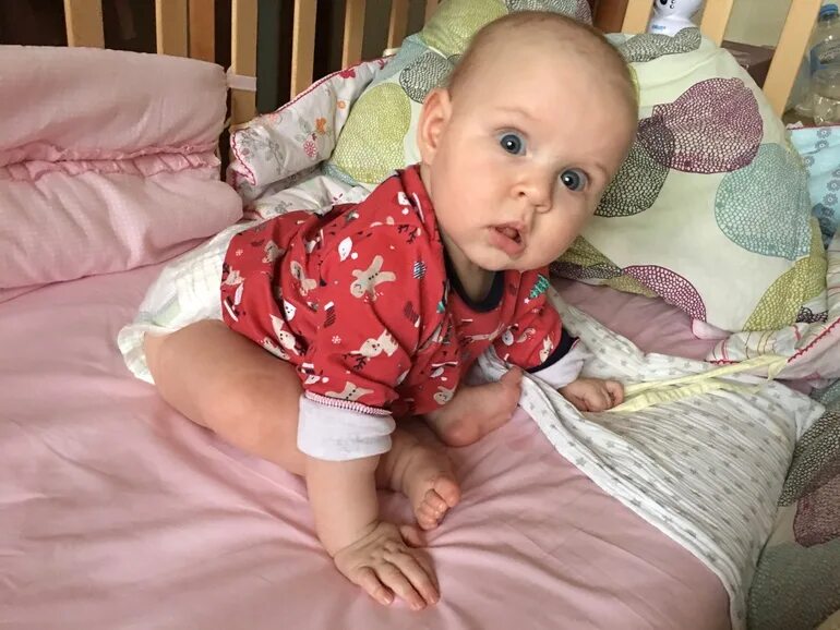 Кривошея у новорожденных в 3 месяца. Кривошея у новорожденных причины. Кривошея в 3 месяца. Кривошея врожденная и приобретенная. Кривошея у новорожденных признаки.